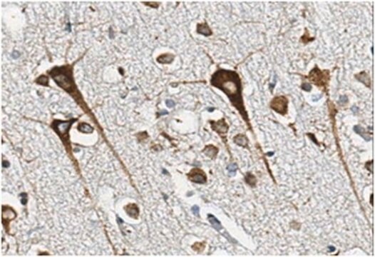 Anti-Beta-mannosidase Antibody, clone 1B3.1 clone 1B3.1, from mouse