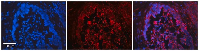 Anti-FOXO3 antibody produced in rabbit affinity isolated antibody