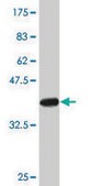 Monoclonal Anti-BCAP31 antibody produced in mouse clone 3C5, purified immunoglobulin, buffered aqueous solution