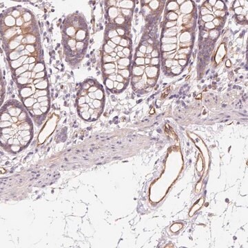Anti-ANKRD13B antibody produced in rabbit Prestige Antibodies&#174; Powered by Atlas Antibodies, affinity isolated antibody, buffered aqueous glycerol solution
