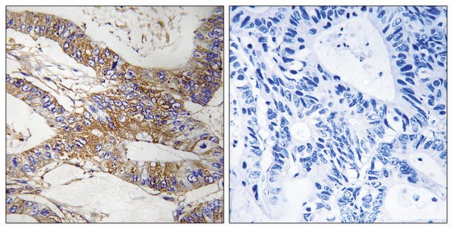Anti-SERPINB9 antibody produced in rabbit affinity isolated antibody