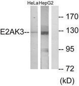 Anti-E2AK3 antibody produced in rabbit affinity isolated antibody