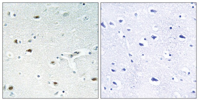 Anti-Retinoblastoma antibody produced in rabbit affinity isolated antibody