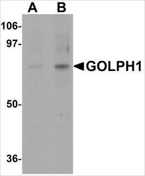 Anti-GOLPH1 antibody produced in rabbit affinity isolated antibody, buffered aqueous solution