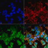 Monoclonal Anti-Kir6.1-FITC antibody produced in mouse clone S366-60