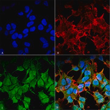 Monoclonal Anti-Kir6.1 antibody produced in mouse clone S366-60