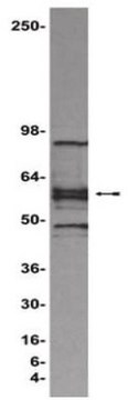 ChIPAb+ LEF1 - ChIP Validated Antibody and Primer Set from mouse