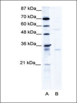 Anti-TRIM17 (AB2) antibody produced in rabbit IgG fraction of antiserum