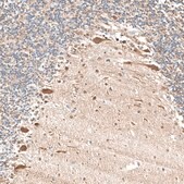 Anti-NTRK1 antibody produced in rabbit Prestige Antibodies&#174; Powered by Atlas Antibodies, affinity isolated antibody, buffered aqueous glycerol solution