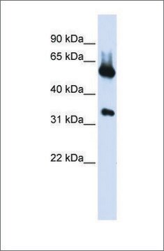 Anti-ALAS2 (ab1) antibody produced in rabbit affinity isolated antibody