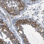 Anti-STIM1 antibody produced in rabbit Prestige Antibodies&#174; Powered by Atlas Antibodies, affinity isolated antibody, buffered aqueous glycerol solution