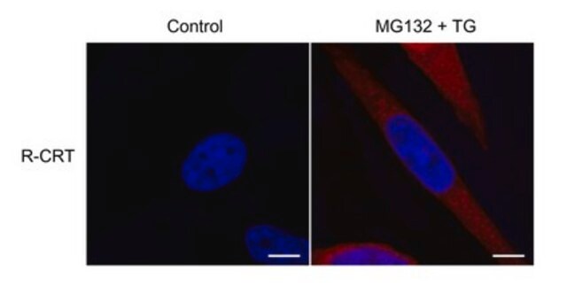 Anti-Calreticulin Antibody, arginylated (Nt-Glu18) from rabbit, purified by affinity chromatography