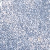 Anti-CFTR antibody produced in rabbit Prestige Antibodies&#174; Powered by Atlas Antibodies, affinity isolated antibody, buffered aqueous glycerol solution