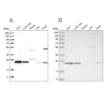 Anti-VPS28 antibody produced in rabbit Prestige Antibodies&#174; Powered by Atlas Antibodies, affinity isolated antibody, buffered aqueous glycerol solution, Ab1