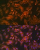 Anti-Calpain 1 Antibody, clone 10E6O5, Rabbit Monoclonal
