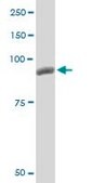 Monoclonal Anti-PYGM antibody produced in mouse clone 2C4, purified immunoglobulin, buffered aqueous solution