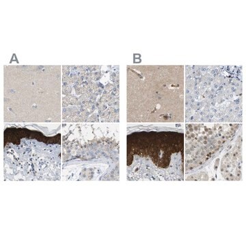 Anti-SERPINB5 antibody produced in rabbit Prestige Antibodies&#174; Powered by Atlas Antibodies, affinity isolated antibody, buffered aqueous glycerol solution