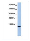 Anti-TNP1 antibody produced in rabbit affinity isolated antibody