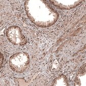 Monoclonal Anti-CDK4 antibody produced in mouse Prestige Antibodies&#174; Powered by Atlas Antibodies, clone CL8102, purified immunoglobulin, buffered aqueous glycerol solution