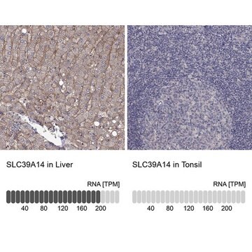 Anti-SLC39A14 antibody produced in rabbit Prestige Antibodies&#174; Powered by Atlas Antibodies, affinity isolated antibody, buffered aqueous glycerol solution