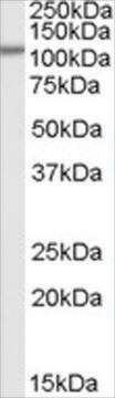 Anti-SMEK1/KIAA2010 antibody produced in goat affinity isolated antibody, buffered aqueous solution