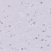 Anti-CDA antibody produced in rabbit Prestige Antibodies&#174; Powered by Atlas Antibodies, affinity isolated antibody, buffered aqueous glycerol solution