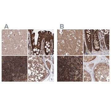 Anti-VPS37B antibody produced in rabbit Prestige Antibodies&#174; Powered by Atlas Antibodies, affinity isolated antibody, buffered aqueous glycerol solution