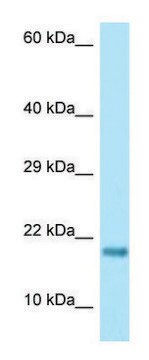 Anti-RPS17 antibody produced in rabbit affinity isolated antibody