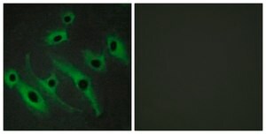 Anti-HER2 antibody produced in rabbit affinity isolated antibody