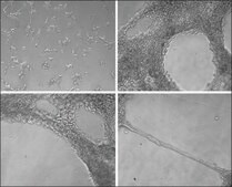 Collagen from Engelbreth-Holm-Swarm murine sarcoma basement membrane Type IV (Miller), lyophilized powder, BioReagent, suitable for cell culture