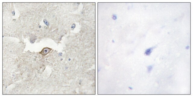 Anti-LMTK2 antibody produced in rabbit affinity isolated antibody