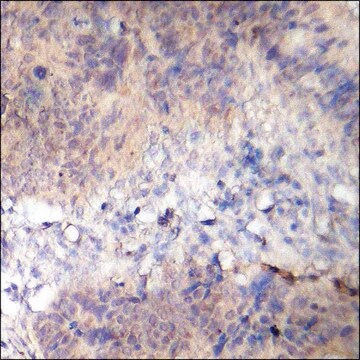 Anti-phospho-AS160 (pThr642) antibody produced in rabbit affinity isolated antibody