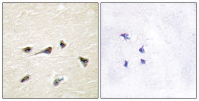 Anti-AKAP12 antibody produced in rabbit affinity isolated antibody