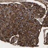 Anti-LIF antibody produced in rabbit Prestige Antibodies&#174; Powered by Atlas Antibodies, affinity isolated antibody, buffered aqueous glycerol solution