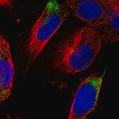 Anti-DPP3 antibody produced in rabbit Prestige Antibodies&#174; Powered by Atlas Antibodies, affinity isolated antibody, buffered aqueous glycerol solution