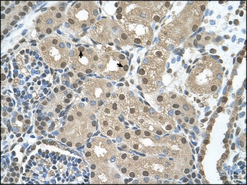 Anti-SBDS (AB1) antibody produced in rabbit IgG fraction of antiserum