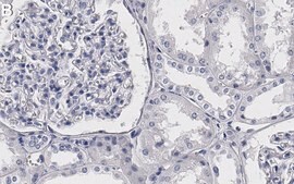 Anti-VEGFR-2 Antibody, clone 3C21 ZooMAb&#174; Rabbit Monoclonal recombinant, expressed in HEK 293 cells