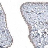 Anti-FGFR2 antibody produced in rabbit Prestige Antibodies&#174; Powered by Atlas Antibodies, affinity isolated antibody, buffered aqueous glycerol solution