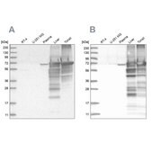 Anti-ALB antibody produced in rabbit Prestige Antibodies&#174; Powered by Atlas Antibodies, affinity isolated antibody, buffered aqueous glycerol solution