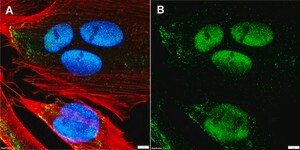 Anti-CDK9 Antibody, clone 1F9 ZooMAb&#174; Rabbit Monoclonal recombinant, expressed in HEK 293 cells