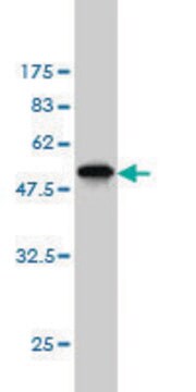 ANTI-AK1 antibody produced in mouse clone 4C2-1A8, purified immunoglobulin, buffered aqueous solution