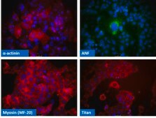 HL-1 Cardiac Muscle Cell Line HL-1 Cardiac Muscle Cell Line has been extensively characterized and is a valuable model system to address questions of cardiac biology at the cellular &amp; molecular levels.