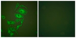 Anti-Keratin 17 antibody produced in rabbit affinity isolated antibody