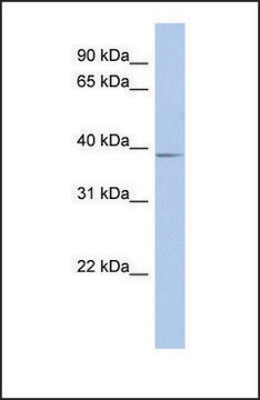 Anti-SLC25A28 antibody produced in rabbit affinity isolated antibody