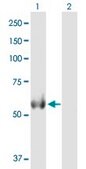 Anti-ALDH4A1 antibody produced in mouse purified immunoglobulin, buffered aqueous solution