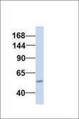 Anti-ABCC3 affinity isolated antibody