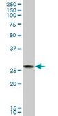 Anti-CTRB1 antibody produced in mouse IgG fraction of antiserum, buffered aqueous solution