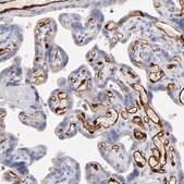 Anti-FABP4 antibody produced in rabbit Prestige Antibodies&#174; Powered by Atlas Antibodies, affinity isolated antibody, buffered aqueous glycerol solution