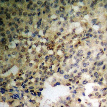 Anti-phospho-TNNI3 (pSer22+Ser23) antibody produced in rabbit affinity isolated antibody