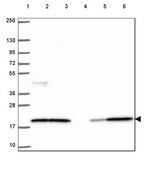 Anti-CFL1 antibody produced in rabbit Prestige Antibodies&#174; Powered by Atlas Antibodies, affinity isolated antibody, buffered aqueous glycerol solution